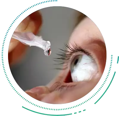 Glaucoma Eye Drops
