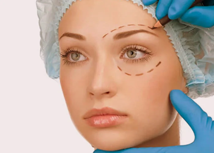 Oculoplasty Treatment